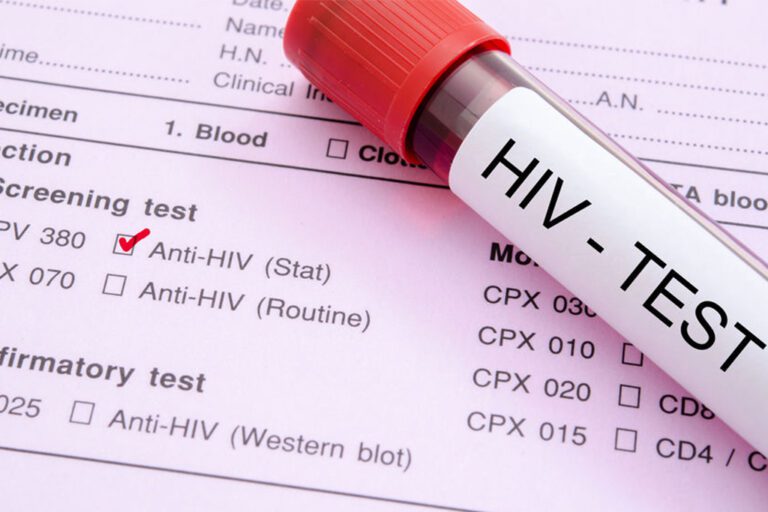 Get Tested for HIV: Taking Control of Your Sexual Health